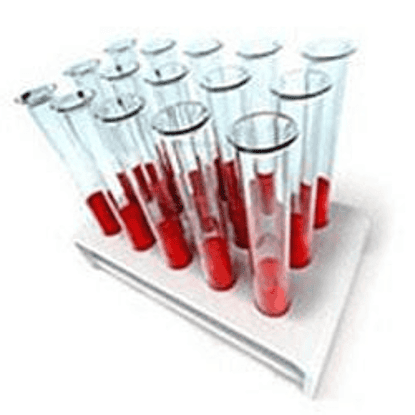 Laboratorio de Análisis Clínicos NSB Química Sanguinea